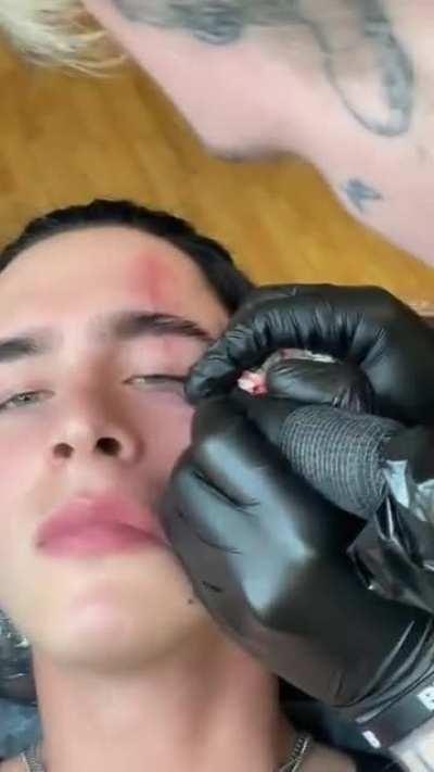 Tattooing a scar on your face
