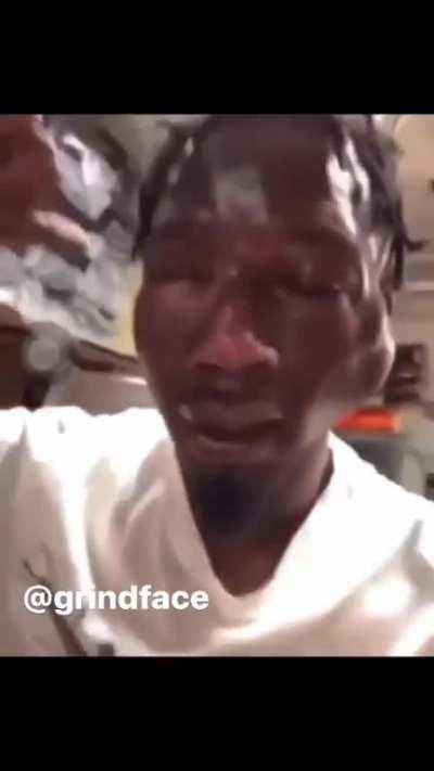 Damn dude got packed out smh. Getting jumped is part of the game but they beat this boy senseless.