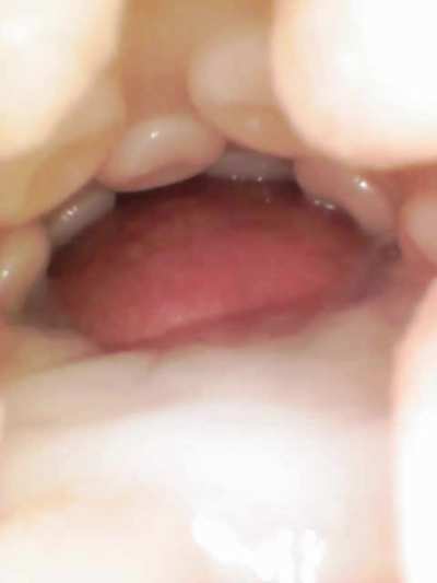 Just milked prostate then immediately emptied rest into fleshlight.