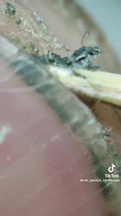 Thanks I hate biting my nails 😖