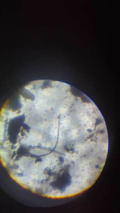 I finally got my tardigrades!