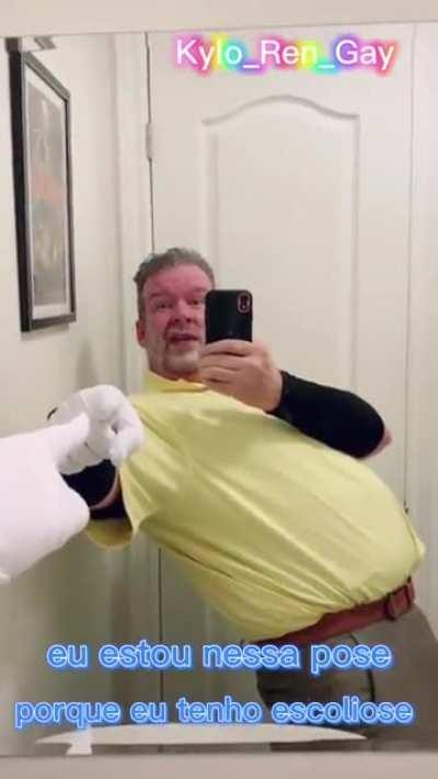 Mas que escoliose foda