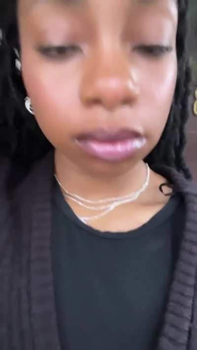 My Ex Always Told Me He Loved My Lips.. What Do You Think?