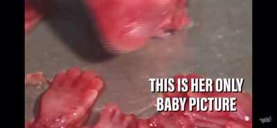 The reality of Abortion