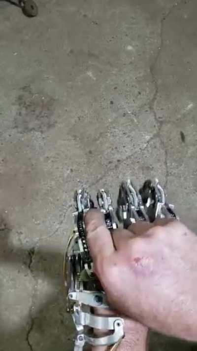 A fully functioning artificial hand