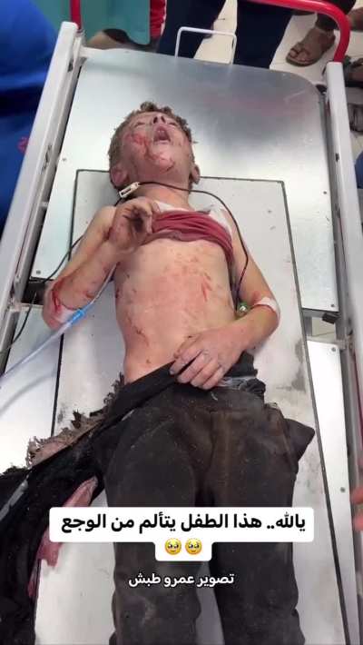 A child screams from pain after being injured by an air strike in Gaza Strip