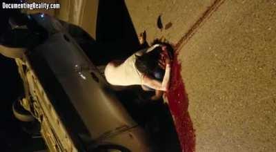 Guy has his skull smashed in a car accident and his gf/wife looses it.