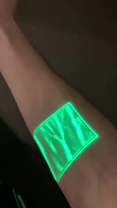 Все равно под кожу загонят