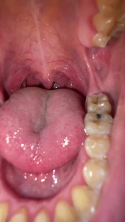 your giant obsession {f}