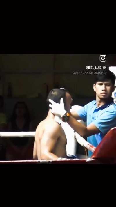 Is this real? How did he get an absolute crater in his head?