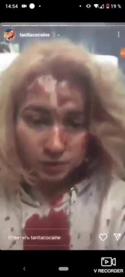 A girl who survived the school 21 bombing in Chernihiv