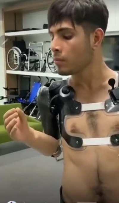 New prosthetics are amazing