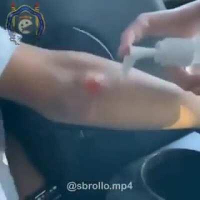 *gemidos de tartaruga inseridos*