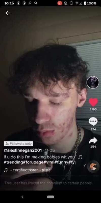 He genuinely repulses me bro he's so hard to look at