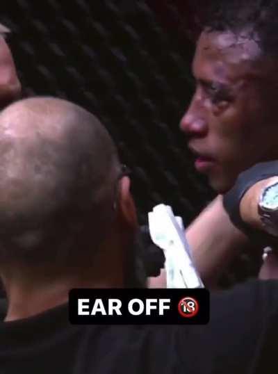 Man Elbowed so Hard his Ear gets Detached