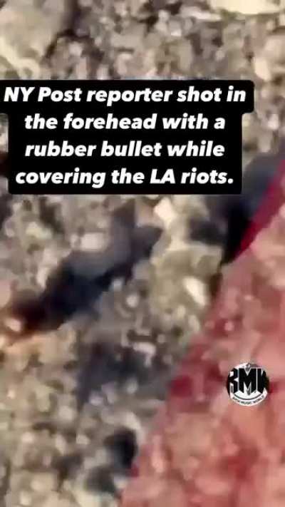 NY Post photographer shot in head with rubber bullet during LA protest.