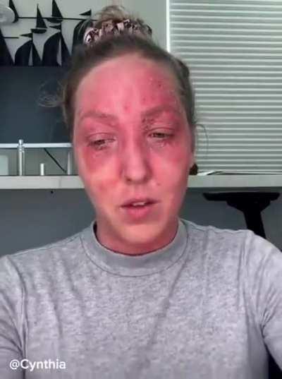 We lost one of our faithful, nevertheless our church remains strong 💪