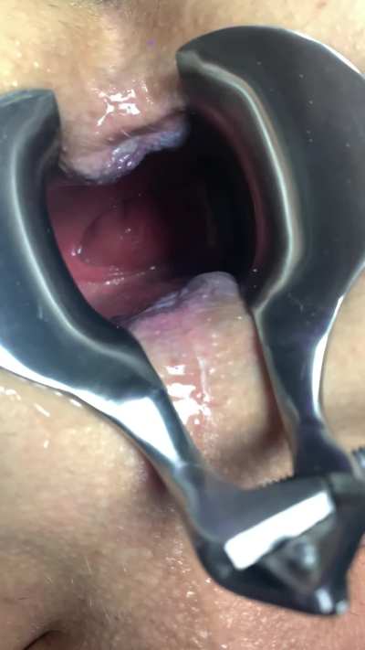 Take a look into my open hole