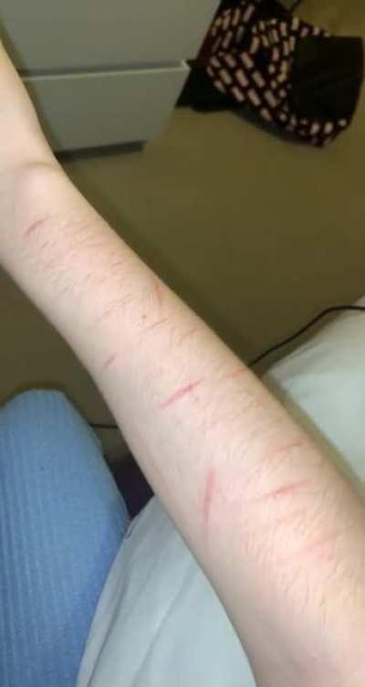 I was very hesitant to post this.. I’m so sorry if it triggers anyone but I’m 15days clean now, I’m hopefully never going to do it again