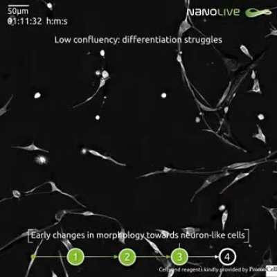 🌟 𝐂𝐞𝐥𝐥𝐮𝐥𝐚𝐫 𝐝𝐢𝐟𝐟𝐞𝐫𝐞𝐧𝐭𝐢𝐚𝐭𝐢𝐨𝐧 𝐢𝐧 𝐞𝐱𝐪𝐮𝐢𝐬𝐢𝐭𝐞 𝐝𝐞𝐭𝐚𝐢𝐥🌟