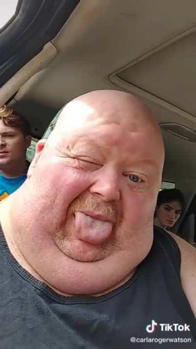 This is what happens when a thumb comes to life.