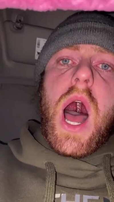 His mouth is a showerhead