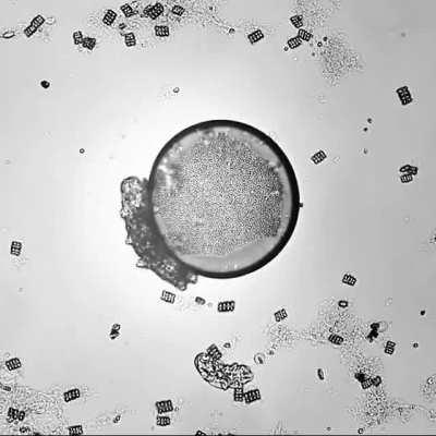 This microscopic water bear appears to be scratching its back, like bears scratch on trees