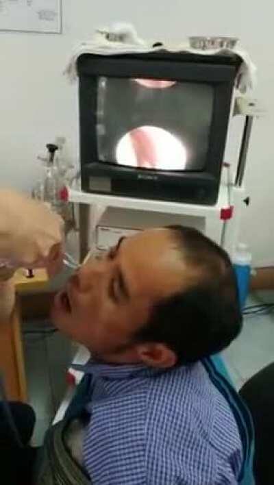 Got a bit of an itch up my nose.