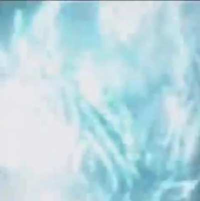 Me and my IBS everyday, barley holding my shit