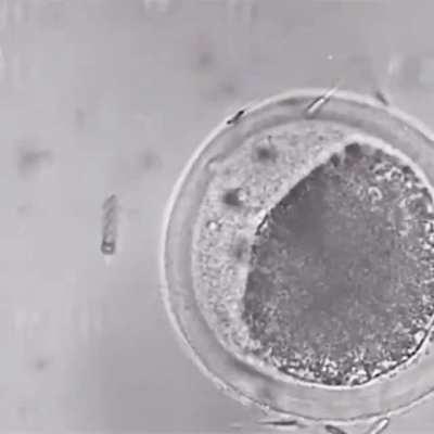 A nanobot helping a sperm with motility issues along towards an egg. These metal helixes are so small they can completely wrap around the tail of a single sperm and assist it along its journey