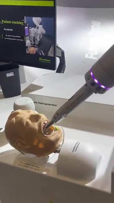 Artificial Intelligence as your new dentist? Would you let this near your mouth? 😮