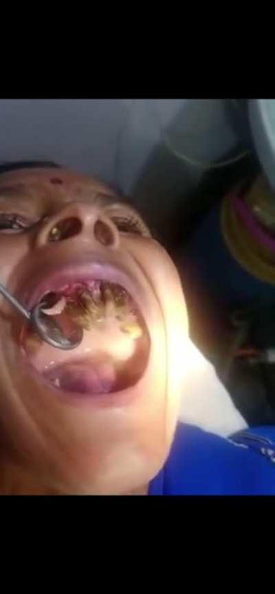 When’s the last time you brushed?