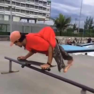 Skater with deformity show off some sick moves