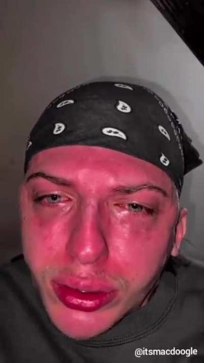 How to pop an aneurysm