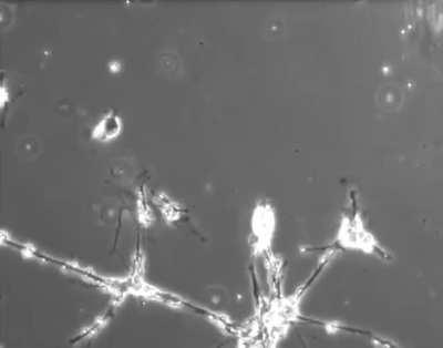 Brain cells in a culture dish trying to form connections with each other