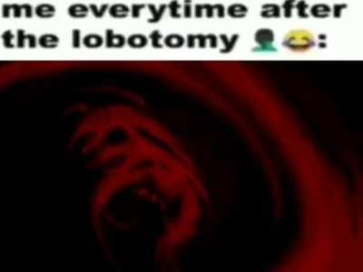 lobotomy 😍