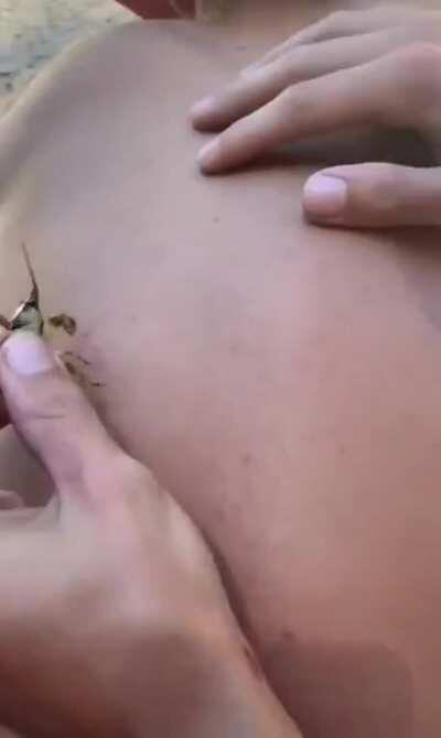Popping a pimple in a very unusual way