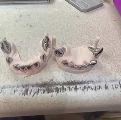 Deke, a 6-year-old German Shepherd from the K-9 unit, received titanium caps on his teeth to keep working because his original teeth had worn down from his duties in drug detection and suspect apprehension.