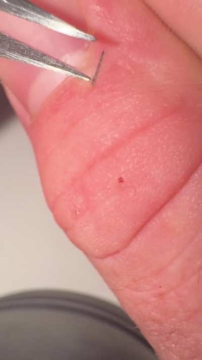 Plucking a splinter