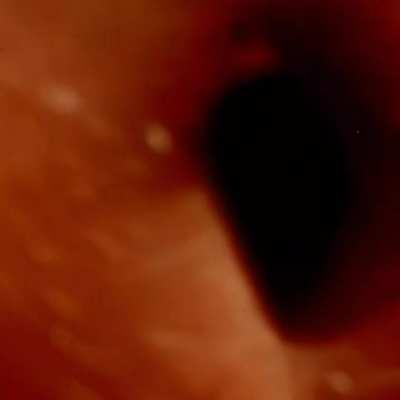 these lot of torpedoes