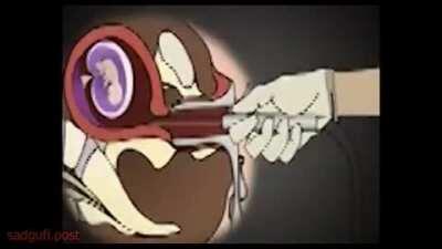 Así se hace en Perú ;)