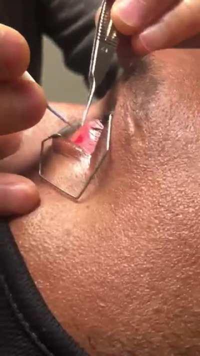 Just a quick eye treatment....