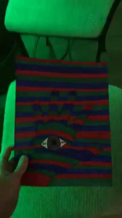 Trippy hands [epilepsy]