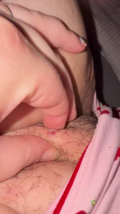 Coochie pop (ingrown hairs, there were 3 hairs in there)