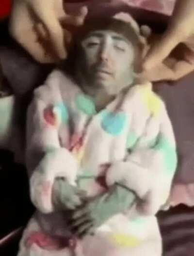 Orson despues de directo