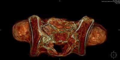 A top view of the internal structure of a pregnant 60cm