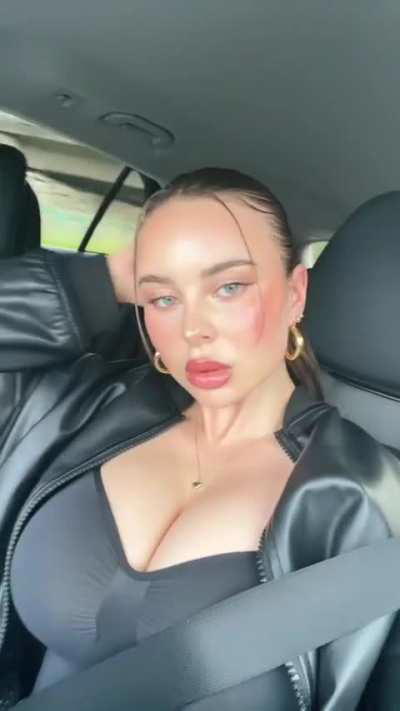 Hier sieht man voll wie krass die ihre Lippen aufgespritzt hat