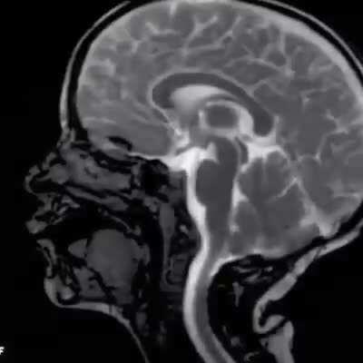 Our Brain Pulsates With Every Heartbeat