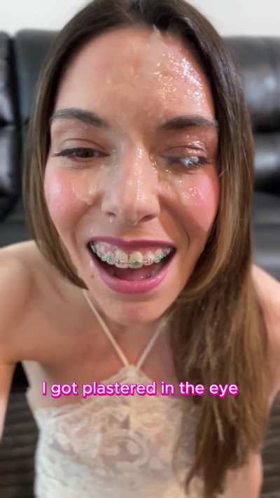 I got plastered in the eye