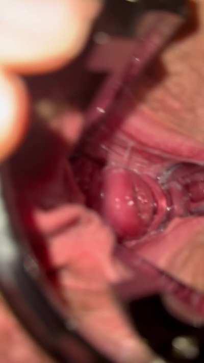 Playing with my cervix